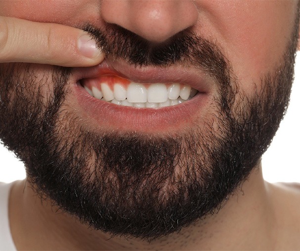 A closeup view of a young man with inflamed gums